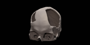 Damaged skull