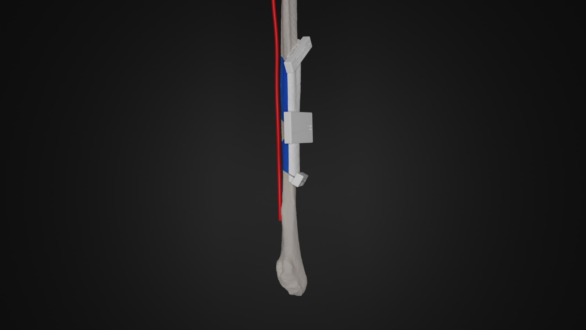 Oncology - 3D-Lab+