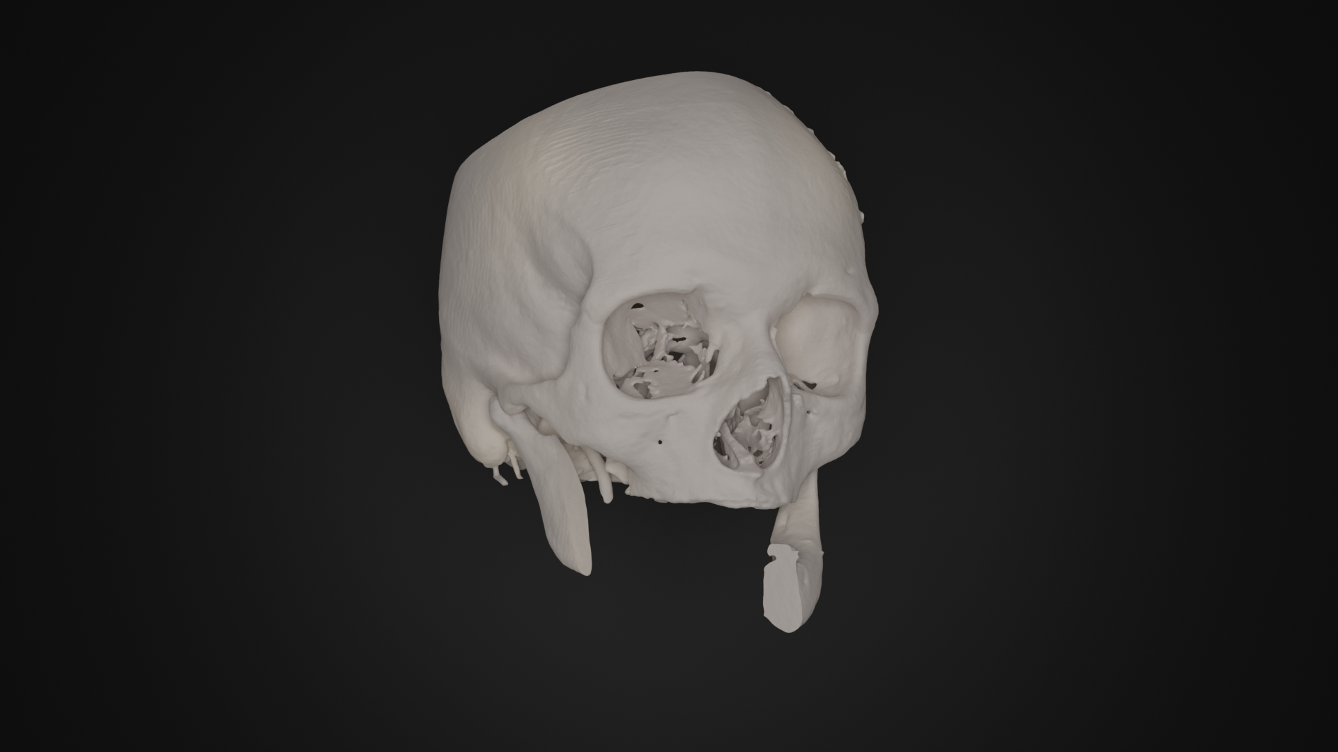 Oncology - 3D-Lab+